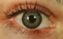 Lentillas Cosméticas - Optica Aguaviva